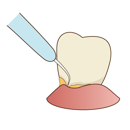 SRP